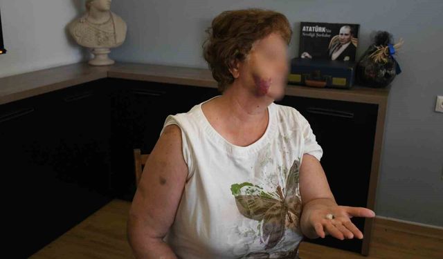 Kuşadası'nda ev kavgası kanlı bitti: Anne ve iki çocuğu bıçaklandı