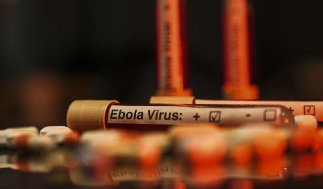 Ebola salgınında can kaybı 3 bin 398'e ulaştı