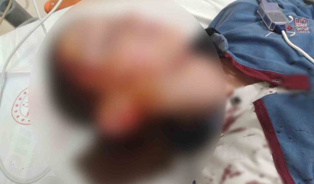 Köpek saldırısında yaralanan çocuk için 1 milyon 200 bin tazminat