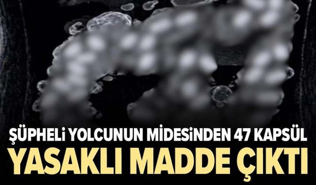 Şüpheli yolcunun midesinden 47 kapsül yasaklı madde çıktı