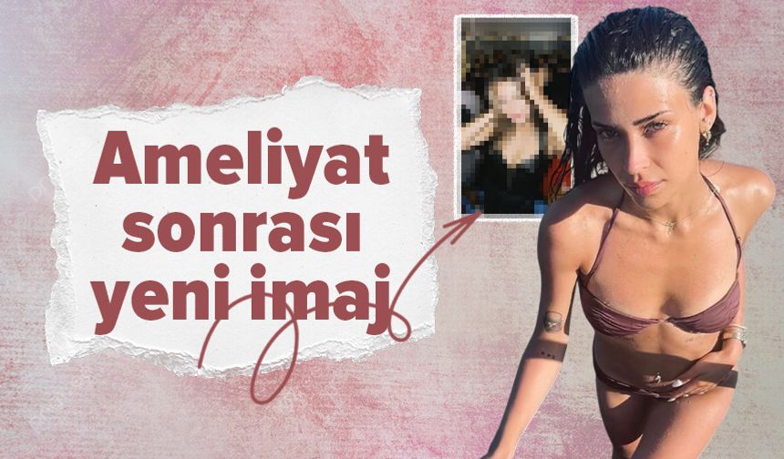 Devrim Özkan'dan ameliyat sonrası yeni imaj