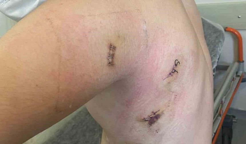 Kız kardeşini korumak isterken 5 yerinden bıçaklanmıştı: O anları anlattı: "Ölümden döndüm"