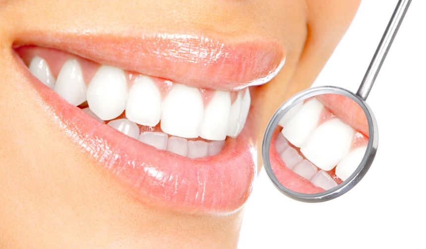 Sararan dişleri inci gibi beyazlatmanın doğal yolları