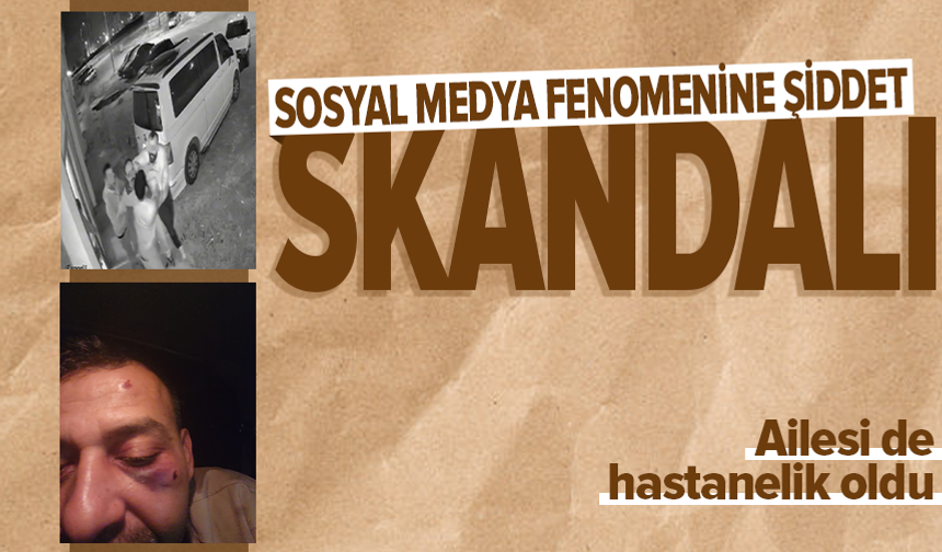 Kukla sanatçısı boşanma aşamasındaki eşi ve ailesi tarafından darbedildi