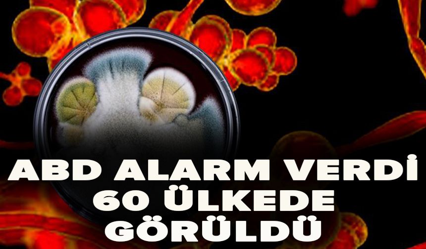 ABD alarm verdi 60 ülkede görüldü