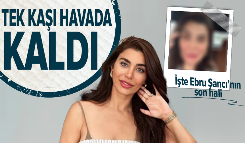 Ebru Şancı botoks kurbanı oldu