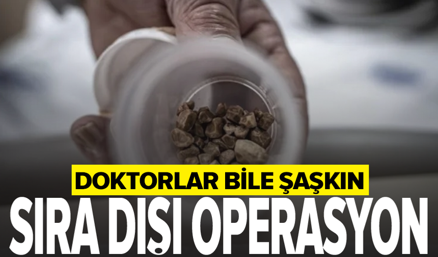 Bir kadının idrar kanalından 51 taş çıkarıldı