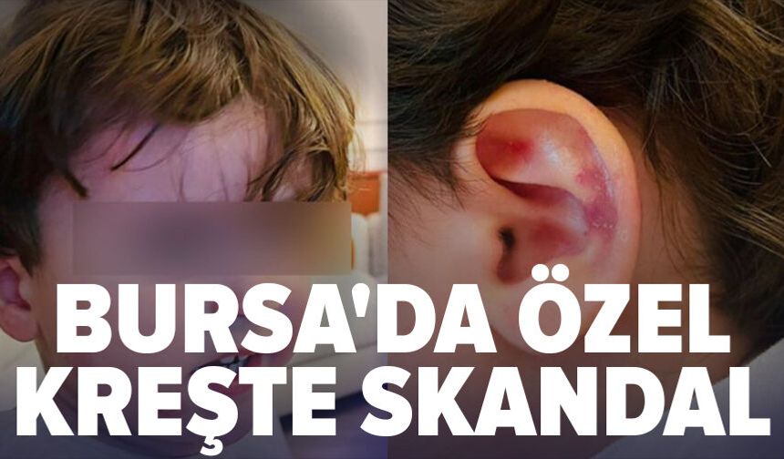 Bursa'da özel kreşte skandal! 2,5 yaşındaki çocuk darp edildi, ailesi görünce şoke oldu