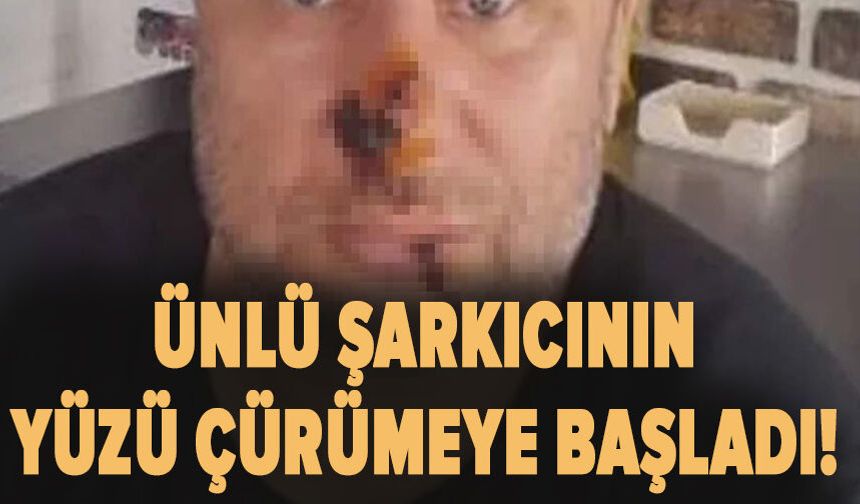 Ünlü şarkıcının yüzü çürümeye başladı!