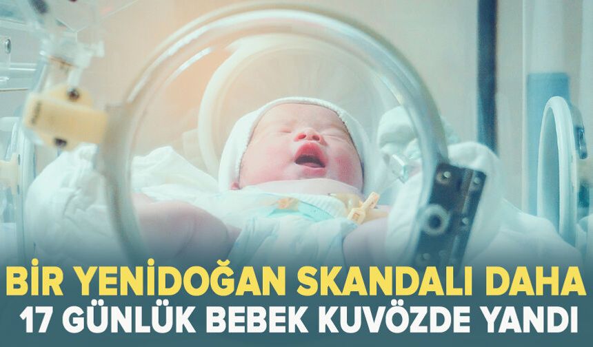 Bir yenidoğan skandalı daha: 17 günlük bebek kuvözde yandı