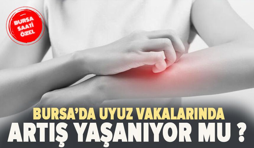 Bursa’da uyuz vakalarında artış yaşanıyor mu?