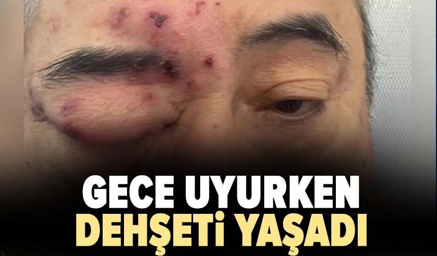Gece uyurken dehşeti yaşadı