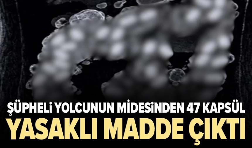 Şüpheli yolcunun midesinden 47 kapsül yasaklı madde çıktı